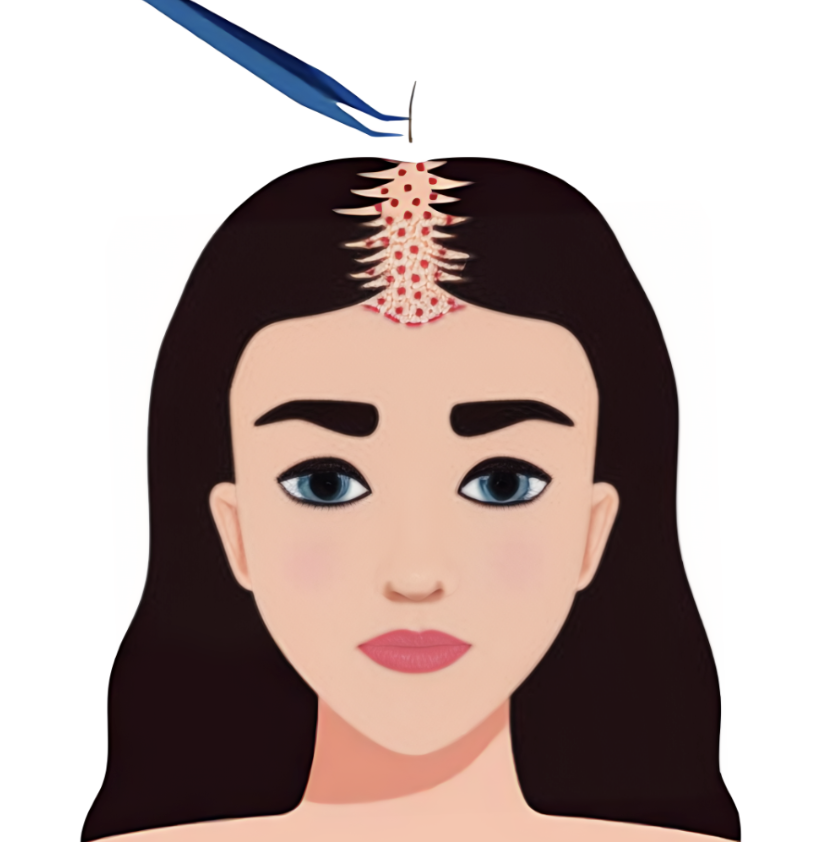 Kadın Saç Ekimi Icon